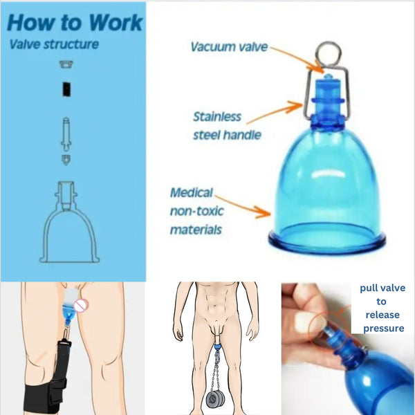 UGM Glans Cup Replacement | Use with the Ligament Traction Trainer for Penile Traction Therapy